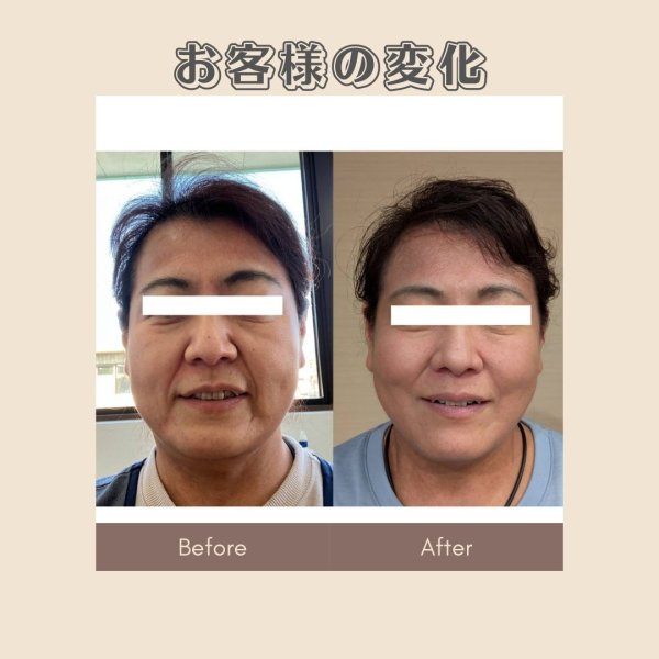 画像3: 顔革命プロジェクト【草柳ありさマスター講師】 (3)