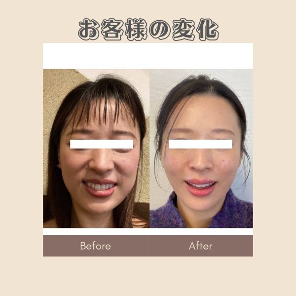 画像2: 顔革命プロジェクト【草柳ありさマスター講師】 (2)
