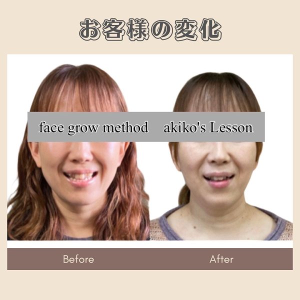 画像2: 顔革命プロジェクト【関亜希子マスター講師】 (2)
