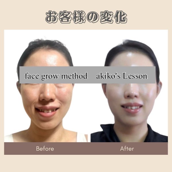 画像4: 顔革命プロジェクト【関亜希子マスター講師】 (4)