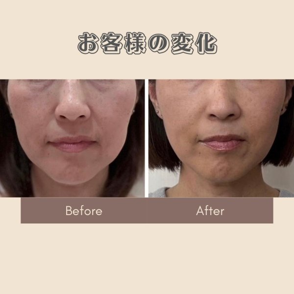 画像3: 顔革命プロジェクト【堀エリカマスター講師】 (3)