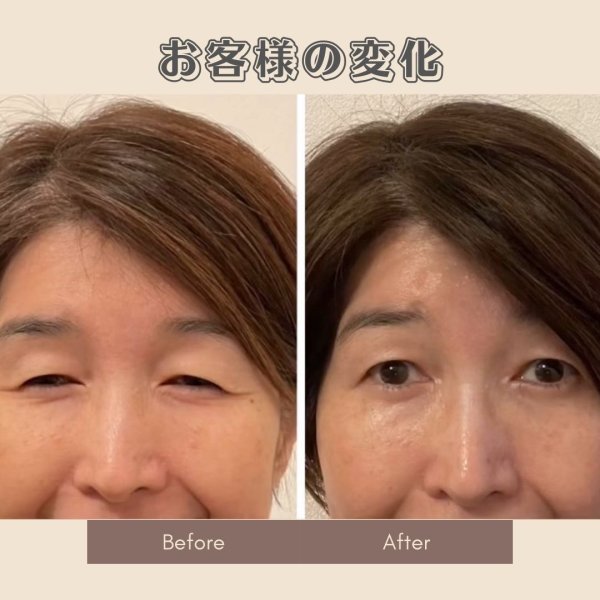 画像4: 顔革命プロジェクト【堀エリカマスター講師】 (4)