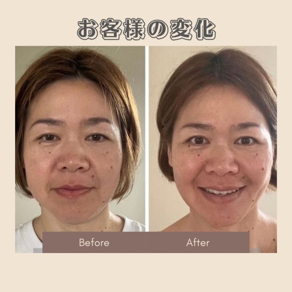 画像2: 顔革命プロジェクト【堀エリカマスター講師】 (2)