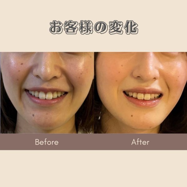 画像4: 顔革命プロジェクト【三浦愛理マスター講師】 (4)