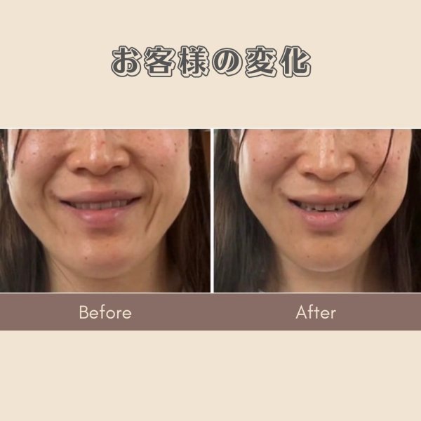 画像3: 顔革命プロジェクト【三浦愛理マスター講師】 (3)