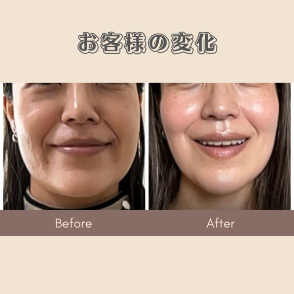 画像2: 顔革命プロジェクト【三浦愛理マスター講師】 (2)