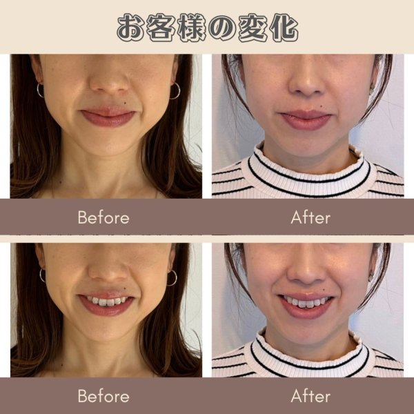 画像4: 顔革命プロジェクト【阿部麻衣マスター講師】 (4)