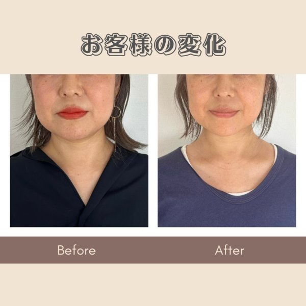 画像3: 顔革命プロジェクト【阿部麻衣マスター講師】 (3)