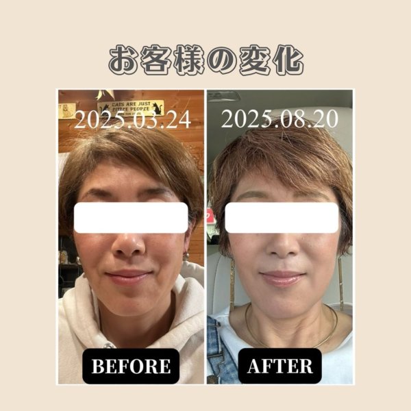 画像4: 顔革命プロジェクト【Jukaマスター講師】 (4)