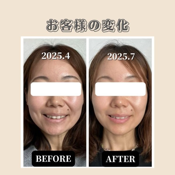 画像2: 顔革命プロジェクト【Jukaマスター講師】 (2)